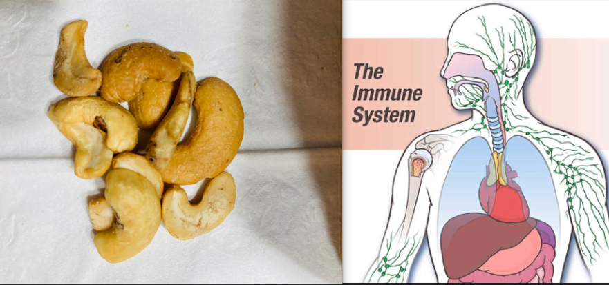 Cashew and the immune system