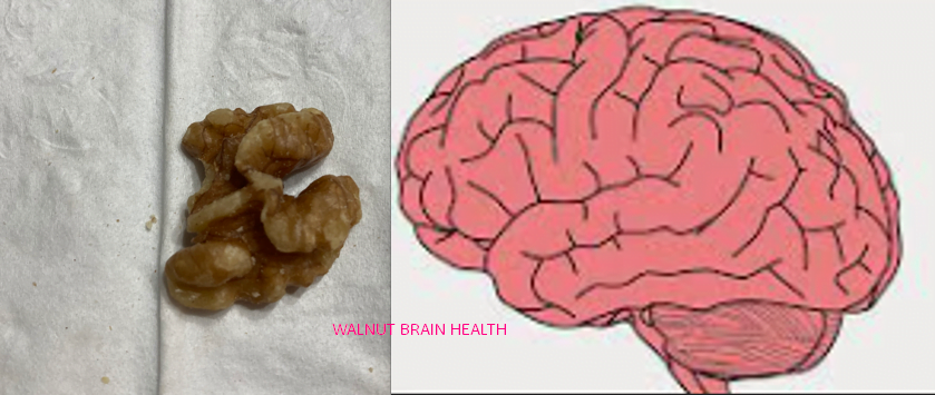Walnut brain health