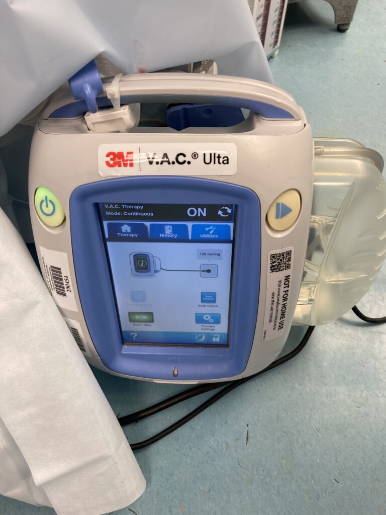 wound vac Screen when in use