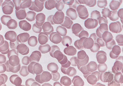 Human red blood cell under microscope
