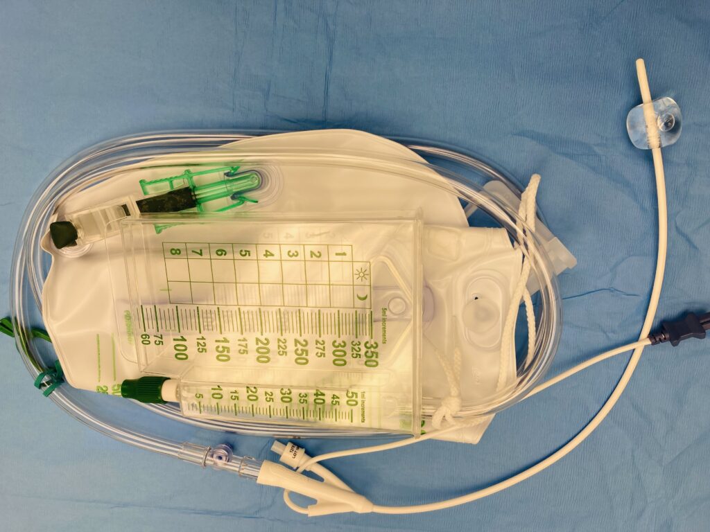 indwelling Foley catheter with drain bag