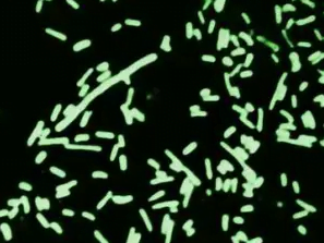 Shigella dysenteriae bacteria revealed through dark field microscopy.